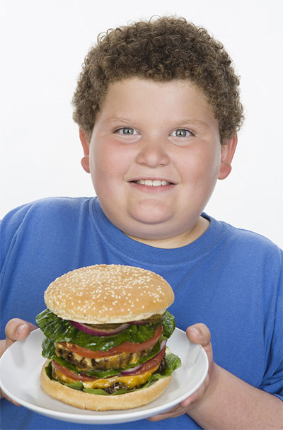 Childhood obesity is now an epidemic